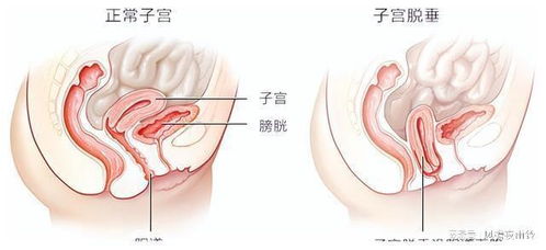 4月官宣三胎5月公布流产,倍速太快被疑是她自导自演