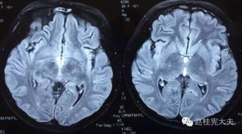 好激烈 你一定没见过这样的病例讨论
