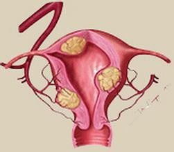 卵巢囊肿能做试管婴儿吗