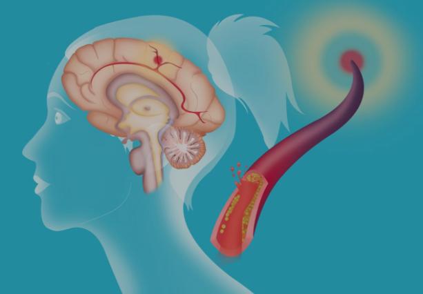经常 手麻 的人要注意了 可能出现了这几种问题,还请多注意