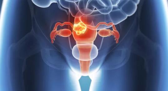 卵巢保养从几岁开始？喝什么预防早衰？再不行动就晚了！