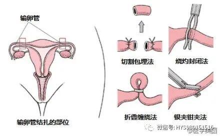 生殖激素 经典的医学美图解析