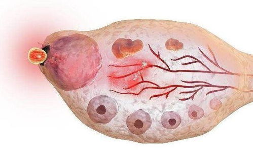 阿sa称阿娇长胖是因荷尔蒙失调,荷尔蒙失调对女性的影响有多大